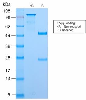 BrdU Antibody - SDS-PAGE Analysis Purified BrdU Rabbit Recombinant Monoclonal Antibody (BRD2888R). Confirmation of Purity and Integrity of Antibody.