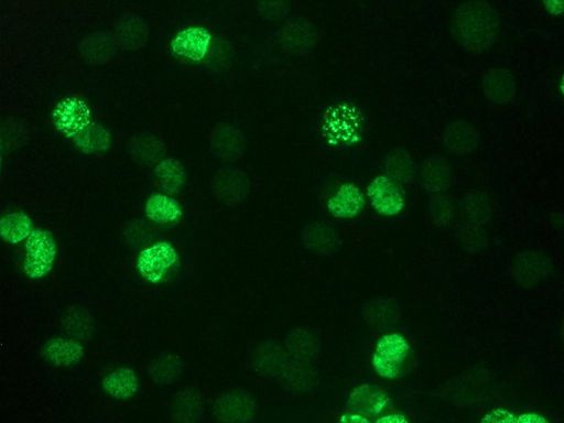 BrdU Antibody - Indirect immunofluorescence staining of BrdU-labeled MR65 lung cancer cells using BrdU (IIB5)