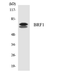 BRF1 Antibody - Western blot analysis of the lysates from HepG2 cells using BRF1 antibody.