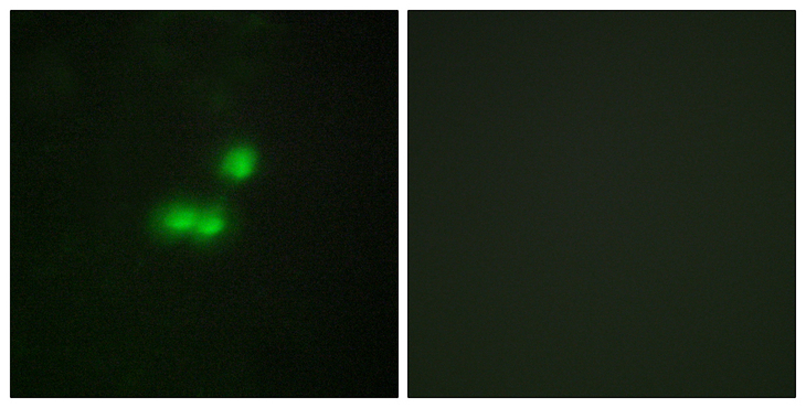 BRF1 Antibody - Immunofluorescence analysis of MCF7 cells, using TF3B Antibody. The picture on the right is blocked with the synthesized peptide.