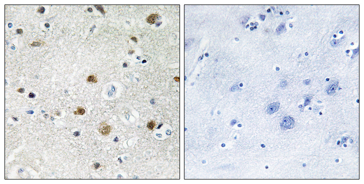 BRF1 Antibody - Immunohistochemistry analysis of paraffin-embedded human brain tissue, using TF3B Antibody. The picture on the right is blocked with the synthesized peptide.