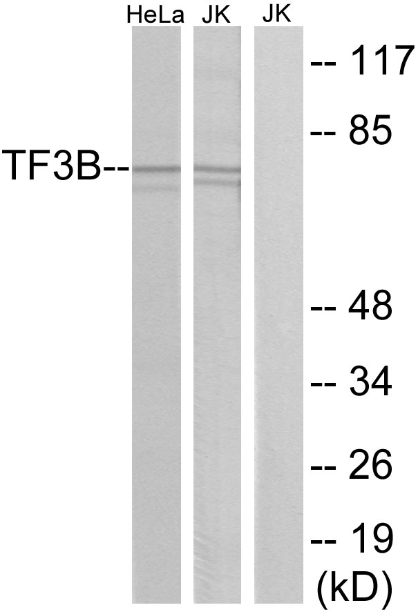 BRF1 Antibody - Western blot analysis of lysates from HeLa and Jurkat cells, using TF3B Antibody. The lane on the right is blocked with the synthesized peptide.