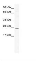 BRF1 Antibody - NIH 3T3 Cell Lysate.  This image was taken for the unconjugated form of this product. Other forms have not been tested.