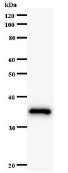 BRF1 Antibody - Western blot of immunized recombinant protein using BRF1 antibody.