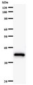 BRF1 Antibody - Western blot of immunized recombinant protein using BRF1 antibody.