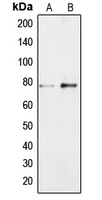 BRF1 Antibody - Western blot analysis of BRF1 expression in Jurkat (A); NIH3T3 (B) whole cell lysates.