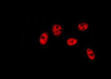 BRF1 Antibody - Staining HeLa cells by IF/ICC. The samples were fixed with PFA and permeabilized in 0.1% Triton X-100, then blocked in 10% serum for 45 min at 25°C. The primary antibody was diluted at 1:200 and incubated with the sample for 1 hour at 37°C. An Alexa Fluor 594 conjugated goat anti-rabbit IgG (H+L) antibody, diluted at 1/600, was used as secondary antibody.