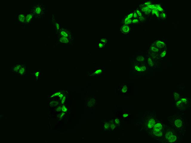 BRF1 Antibody - Immunofluorescence staining of BRF1 in MCF7 cells. Cells were fixed with 4% PFA, permeabilzed with 0.3% Triton X-100 in PBS, blocked with 10% serum, and incubated with rabbit anti-Human BRF1 polyclonal antibody (dilution ratio 1:200) at 4°C overnight. Then cells were stained with the Alexa Fluor 488-conjugated Goat Anti-rabbit IgG secondary antibody (green). Positive staining was localized to Nucleus.