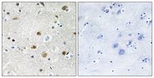 BRF1 Antibody - Peptide - + Immunohistochemistry analysis of paraffin-embedded human brain tissue using TF3B antibody.