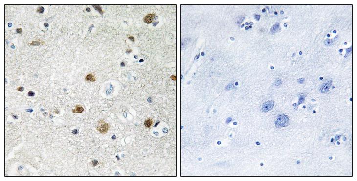 BRF1 Antibody - Peptide - + Immunohistochemistry analysis of paraffin-embedded human brain tissue using TF3B antibody.