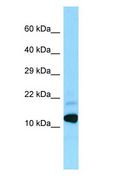 BRI3 Antibody - BRI3 antibody Western Blot of Fetal Heart.  This image was taken for the unconjugated form of this product. Other forms have not been tested.