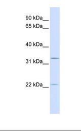 BRI3BP Antibody - Transfected 293T cell lysate. Antibody concentration: 1.0 ug/ml. Gel concentration: 12%.  This image was taken for the unconjugated form of this product. Other forms have not been tested.