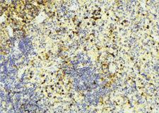 BRI3BP Antibody - 1:100 staining mouse liver tissue by IHC-P. The sample was formaldehyde fixed and a heat mediated antigen retrieval step in citrate buffer was performed. The sample was then blocked and incubated with the antibody for 1.5 hours at 22°C. An HRP conjugated goat anti-rabbit antibody was used as the secondary.