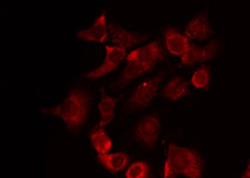 BRI3BP Antibody - Staining RAW264.7 cells by IF/ICC. The samples were fixed with PFA and permeabilized in 0.1% Triton X-100, then blocked in 10% serum for 45 min at 25°C. The primary antibody was diluted at 1:200 and incubated with the sample for 1 hour at 37°C. An Alexa Fluor 594 conjugated goat anti-rabbit IgG (H+L) Ab, diluted at 1/600, was used as the secondary antibody.