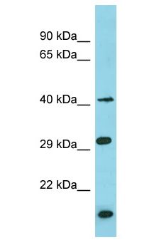 BRICD5 Antibody - BRICD5 antibody Western Blot of THP-1. Antibody dilution: 1 ug/ml.  This image was taken for the unconjugated form of this product. Other forms have not been tested.