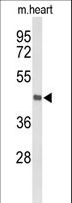 BRINP1 / DBC1 Antibody - Western blot of DBC1 Antibody in mouse heart tissue lysates (35 ug/lane). DBC1 (arrow) was detected using the purified antibody.