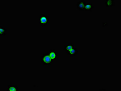 BRINP1 / DBC1 Antibody - Immunofluorescent analysis of HepG2 cells using BRINP1 Antibody at dilution of 1:100 and Alexa Fluor 488-congugated AffiniPure Goat Anti-Rabbit IgG(H+L)