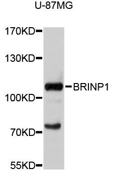 BRINP1 / DBC1 Antibody - Western blot analysis of extracts of U-87MG cells, using BRINP1 antibody at 1:1000 dilution. The secondary antibody used was an HRP Goat Anti-Rabbit IgG (H+L) at 1:10000 dilution. Lysates were loaded 25ug per lane and 3% nonfat dry milk in TBST was used for blocking. An ECL Kit was used for detection and the exposure time was 1s.