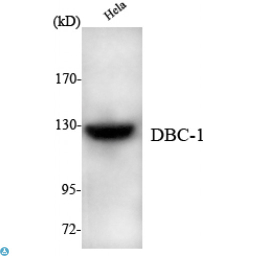 BRINP1 / DBC1 Antibody - Western Blot (WB) analysis using DBC-1 Monoclonal Antibody against HeLa cell lysate.