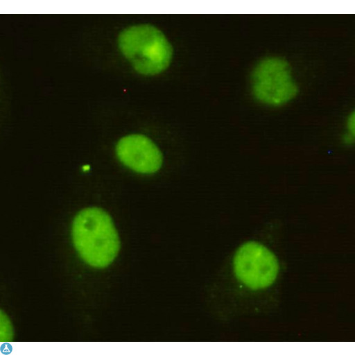 BRINP1 / DBC1 Antibody - Immunocytochemistry (ICC) of HeLa cells using anti-DBC1 Mouse Monoclonal Antibody diluted 1:200.
