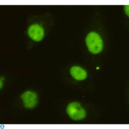 BRINP1 / DBC1 Antibody - Immunocytochemistry of HeLa cells using anti-DBC1 mouse mAb diluted 1:200.