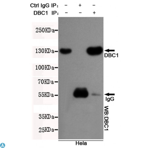 BRINP1 / DBC1 Antibody - Immunoprecipitation analysis of Hela cell lysates using DBC1 mouse mAb.
