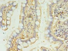 BRINP2 / FAM5B Antibody - Immunohistochemistry of paraffin-embedded human small intestine tissue using antibody at dilution of 1:100.