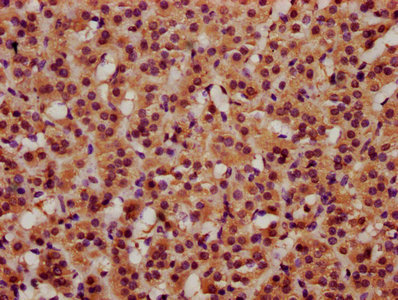BRINP3 / FAM5C Antibody - Immunohistochemistry Dilution at 1:600 and staining in paraffin-embedded human adrenal gland tissue performed on a Leica BondTM system. After dewaxing and hydration, antigen retrieval was mediated by high pressure in a citrate buffer (pH 6.0). Section was blocked with 10% normal Goat serum 30min at RT. Then primary antibody (1% BSA) was incubated at 4°C overnight. The primary is detected by a biotinylated Secondary antibody and visualized using an HRP conjugated SP system.