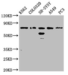BRINP3 / FAM5C Antibody - Western Blot Positive WB detected in: K562 whole cell lysate, COLO320 whole cell lysate, SH-SY5Y whole cell lysate, A549 whole cell lysate, PC3 whole cell lysate All Lanes: BRINP3 antibody at 3.8µg/ml Secondary Goat polyclonal to rabbit IgG at 1/50000 dilution Predicted band size: 89, 77 KDa Observed band size: 77 KDa