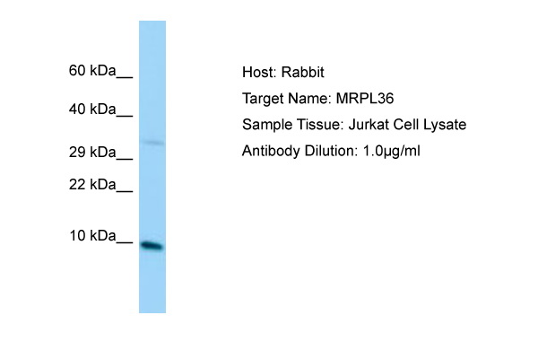 BRIP1 / BACH1 Antibody -  This image was taken for the unconjugated form of this product. Other forms have not been tested.