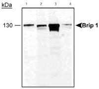 BRIP1 / BACH1 Antibody - Brip 1 detected in cell lysates. Lane 1: MCF-7 lysate, Lane 2: HeLa lysate, Lane 3:293 lysate and Lane 4: SKOV3 lysate.