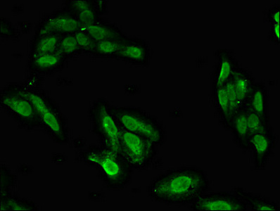 BRIP1 / BACH1 Antibody - Immunofluorescent analysis of Hela cells diluted at 1:100 and Alexa Fluor 488-congugated AffiniPure Goat Anti-Rabbit IgG(H+L)