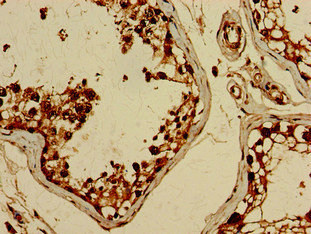 BRIP1 / BACH1 Antibody - Immunohistochemistry of paraffin-embedded human testis tissue at dilution of 1:100