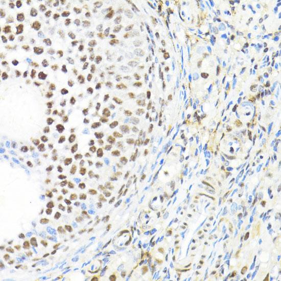 BRIP1 / BACH1 Antibody - Immunohistochemistry of paraffin-embedded Rat ovary using BACH1 Polyclonal Antibody at dilution of 1:100 (40x lens).
