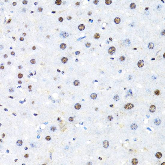 BRIP1 / BACH1 Antibody - Immunohistochemistry of paraffin-embedded Mouse liver using BACH1 Polyclonal Antibody at dilution of 1:100 (40x lens).