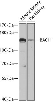 BRIP1 / BACH1 Antibody - Western blot analysis of extracts of various cell lines using BACH1 Polyclonal Antibody at dilution of 1:3000.