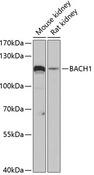 BRIP1 / BACH1 Antibody - Western blot analysis of extracts of various cell lines using BACH1 Polyclonal Antibody at dilution of 1:3000.