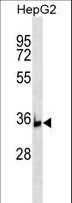 BRIX1 Antibody - BRIX1 Antibody western blot of HepG2 cell line lysates (35 ug/lane). The BRIX1 antibody detected the BRIX1 protein (arrow).