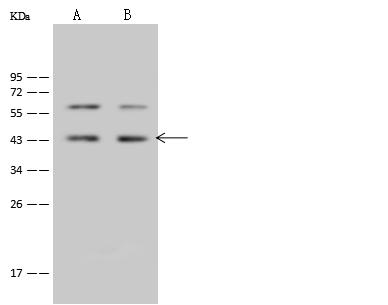 BRIX1 Antibody - Anti-BRIX1 rabbit polyclonal antibody at 1:500 dilution. Lane A: HepG2 Whole Cell Lysate. Lane B: A549 Whole Cell Lysate. Lysates/proteins at 30 ug per lane. Secondary: Goat Anti-Rabbit IgG (H+L)/HRP at 1/10000 dilution. Developed using the ECL technique. Performed under reducing conditions. Predicted band size: 41 kDa. Observed band size: 43 kDa.