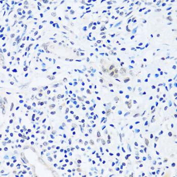BRIX1 Antibody - Immunohistochemistry of paraffin-embedded Human appendix using BRIX1 Polyclonal Antibody at dilution of 1:100 (40x lens).