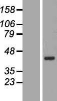 BRIX1 Protein - Western validation with an anti-DDK antibody * L: Control HEK293 lysate R: Over-expression lysate
