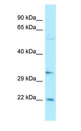 BRMS1 Antibody - BRMS1 antibody Western Blot of 721_B cell lysate. BRMS1 is supported by BioGPS gene expression data to be expressed in 721_B.  This image was taken for the unconjugated form of this product. Other forms have not been tested.