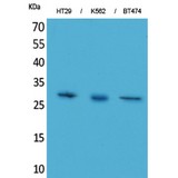 BRMS1 Antibody - Western blot of BRMS-1 antibody