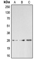 BRMS1 Antibody - Western blot analysis of BRMS1 expression in HepG2 (A); HeLa (B); K562 (C) whole cell lysates.