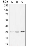 BRMS1 Antibody - Western blot analysis of BRMS1 expression in HT29 (A); HeLa (B); MCF7 (C) whole cell lysates.