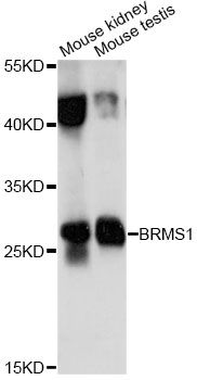 BRMS1 Antibody - Western blot analysis of extracts of various cell lines, using BRMS1 antibody at 1:1000 dilution. The secondary antibody used was an HRP Goat Anti-Rabbit IgG (H+L) at 1:10000 dilution. Lysates were loaded 25ug per lane and 3% nonfat dry milk in TBST was used for blocking. An ECL Kit was used for detection and the exposure time was 10s.
