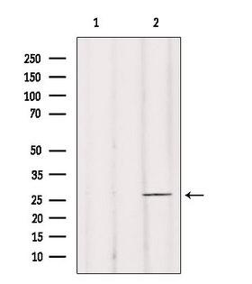 BRMS1 Antibody - Western blot analysis of extracts of mouse brain tissue using BRMS1 antibody. Lane 1 was treated with the antigen-specific peptide.