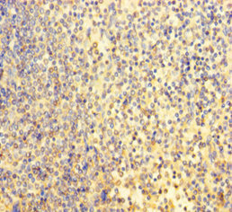 BRN2 / POU3F2 Antibody - Immunohistochemistry of paraffin-embedded human spleen tissue at dilution of 1:100