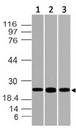BRN2 / POU3F2 Antibody - Fig-1: Expression analysis of POU3F2. Anti-POU3F2 antibody was used at 1 µg/ml on (1) K562, (2) HCT-116 and (3) 293 lysates
