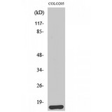 BRP44L Antibody - Western blot of Brp44L antibody